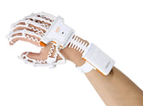 NEOFECT Smart Glove System