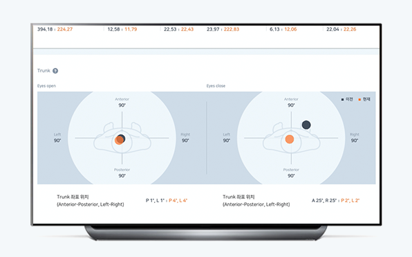 NEOFECT Smart Balance System